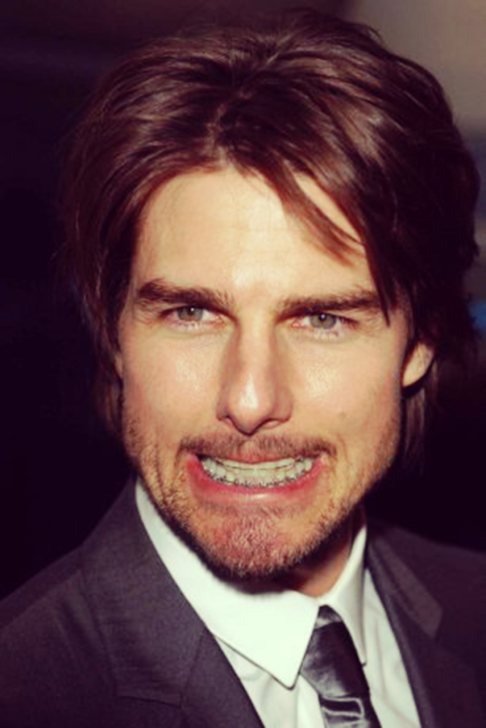 tom cruise orthodontics